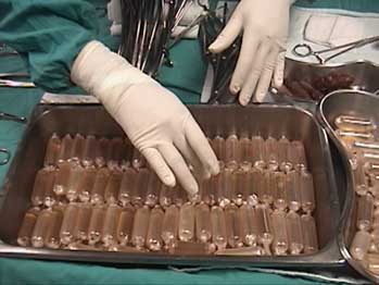 drugs in stomach