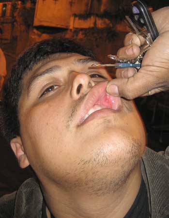 famous lip